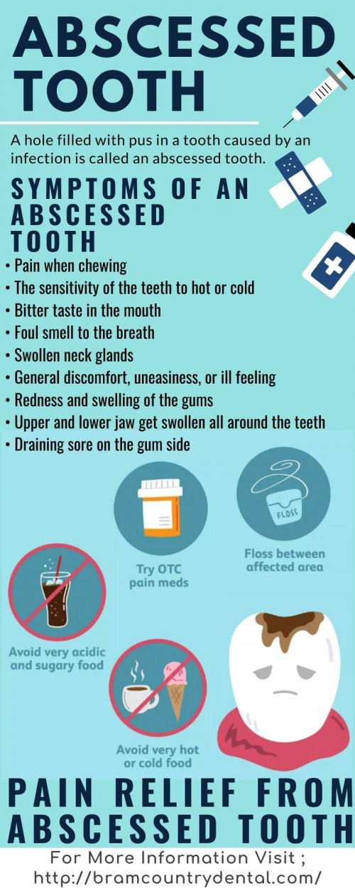 Abscessed-Tooth-treatment.jpg