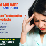 Acupuncture-Treatment-for-Headache