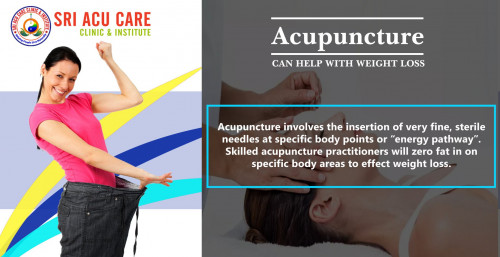 Best-Acupuncture-Clinic-Tirupati-_Tirupati-Acupuncture-_All-Kind-of-Treatments_Best-Acupuncture-Clinic-Andhra-pradesh-4.jpg