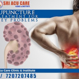 Best-Acupuncture-Treatment-for-Kidney-failure-2.jpg