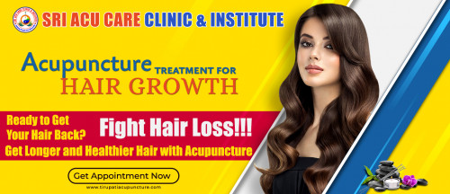 Best Acupuncture tirupati, Acupuncture Treatment for Hair growth