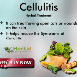 Cellulitis