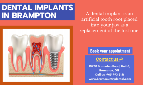 Dental-Implants-Treatment.png