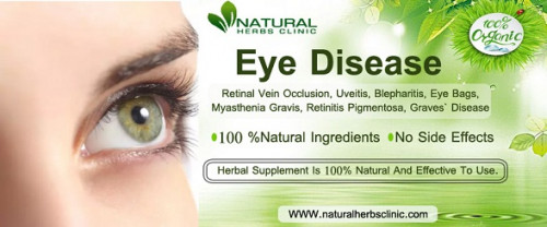 Herbal-Products-For-Eye-Diseases.jpg