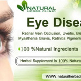 Herbal-Products-For-Eye-Diseases