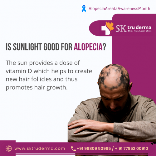 Is sunlight good for alopecia, Best Dermatologist in Sarjapur Road