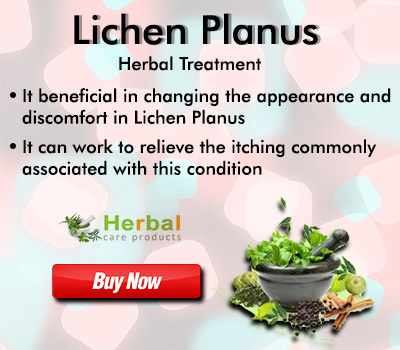 Lichen-Planus.jpg