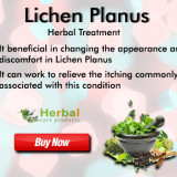 Lichen-Planus61336c486c546a27