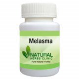 Melasma-Herbal-Treatment-500x500-1-1