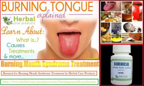 The Herbal Treatment of Burning Mouth Syndrome aims to reduce the symptoms. There are many home remedies which you can utilize for treating dry mouth,