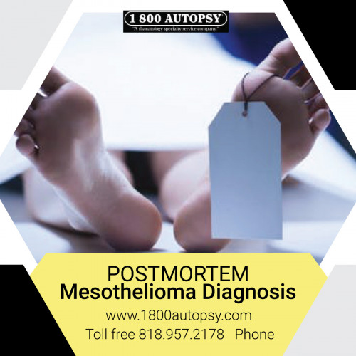 Postmortem-Mesothelioma-Diagnosis.jpg