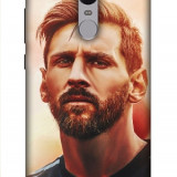 Redmi_Note-4_0270
