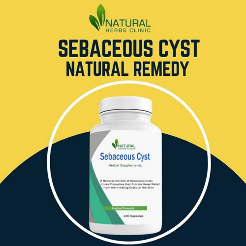 Essential Oils for Sebaceous Cyst