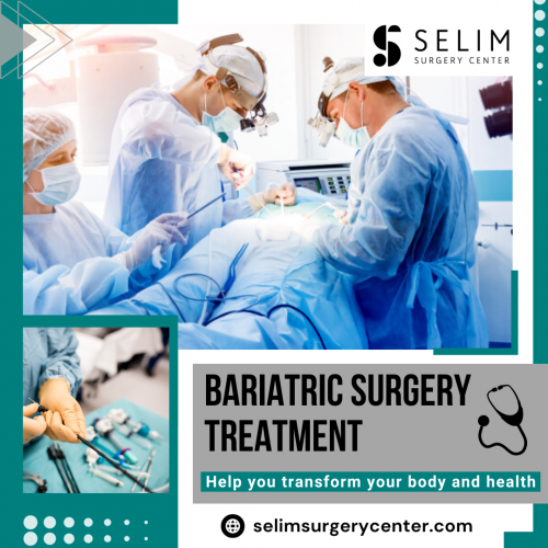 Bariatric treatment can provide effective and sustainable weight loss for patients. Our team carefully evaluates each person to determine if they are a good candidate for surgery. For more information, mail us at contact@selimsurgerycenter.com.