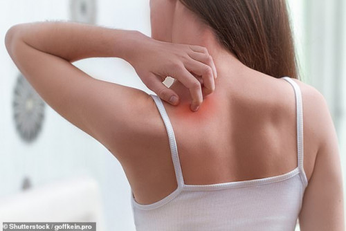 Get relief from the irritation and inflammation of Granuloma Annulare with Soothing the Itch. Learn how to make this simple remedy for fast and effective relief. https://articlescad.com/soothing-the-itch-granuloma-annulare-relief-make-simple-14618.html
