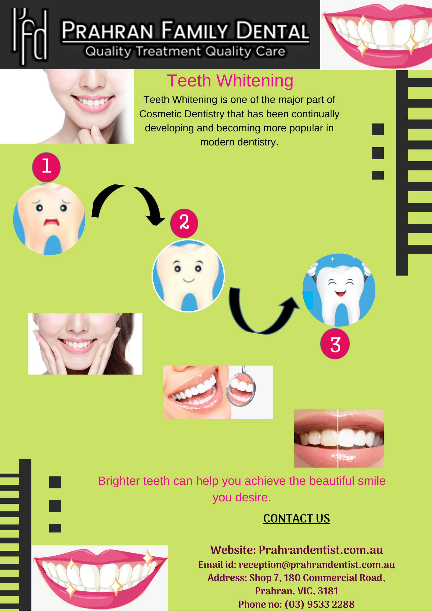 Best Teeth Whitening Melbourne Prahran Family Dental Gifyu