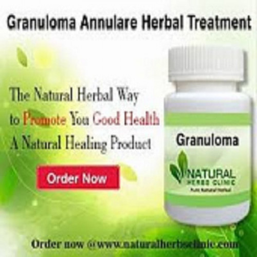 Granuloma annulare is very comparable the same to psoriasis in that together is incendiary immune system matter of the skin. We utilize the Natural Remedies for Granuloma Annulare and the skin detox method for Natural Treatment for Granuloma Annulare . http://herbsnaturalclinic.weebly.com/blog/utilize-natural-remedies-to-abolish-granuloma-annulare-skin-disease