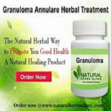 Utilize-Natural-Remedies-to-abolish-Granuloma-Annulare-Skin-Disease