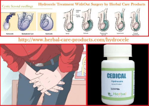 Herbal Treatment for Hydrocele without surgery at home by natural herbal remedies. We also define hydrocele info like symptoms, causes etc. Online cure swelling of disease is Cedical for patients.
http://herbal-care-products.yolasite.com/natural-herbal-treatment-for-hydrocele-symptoms.php