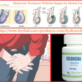 hydrocele-herbal-treatment.jpg.opt860x612o00s860x612