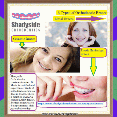For clear braces in Shadyside, PA visit Shadyside Orthodontics treatment center. Dr. Maria is certified and expert in all kinds of orthodontics and also deal in braces. She is a member of AAO & certified ABO dentist. For free consultation & appointment, visit our website today.
https://www.shadysideorthodontics.com/types-braces/