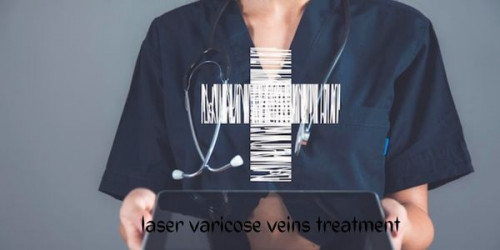 laser-varicose-veins-treatment.jpg